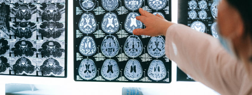 Bebeklerde Beyin Gelişimi