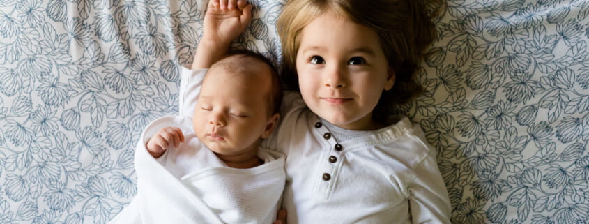 Sturge Weber Sendromu